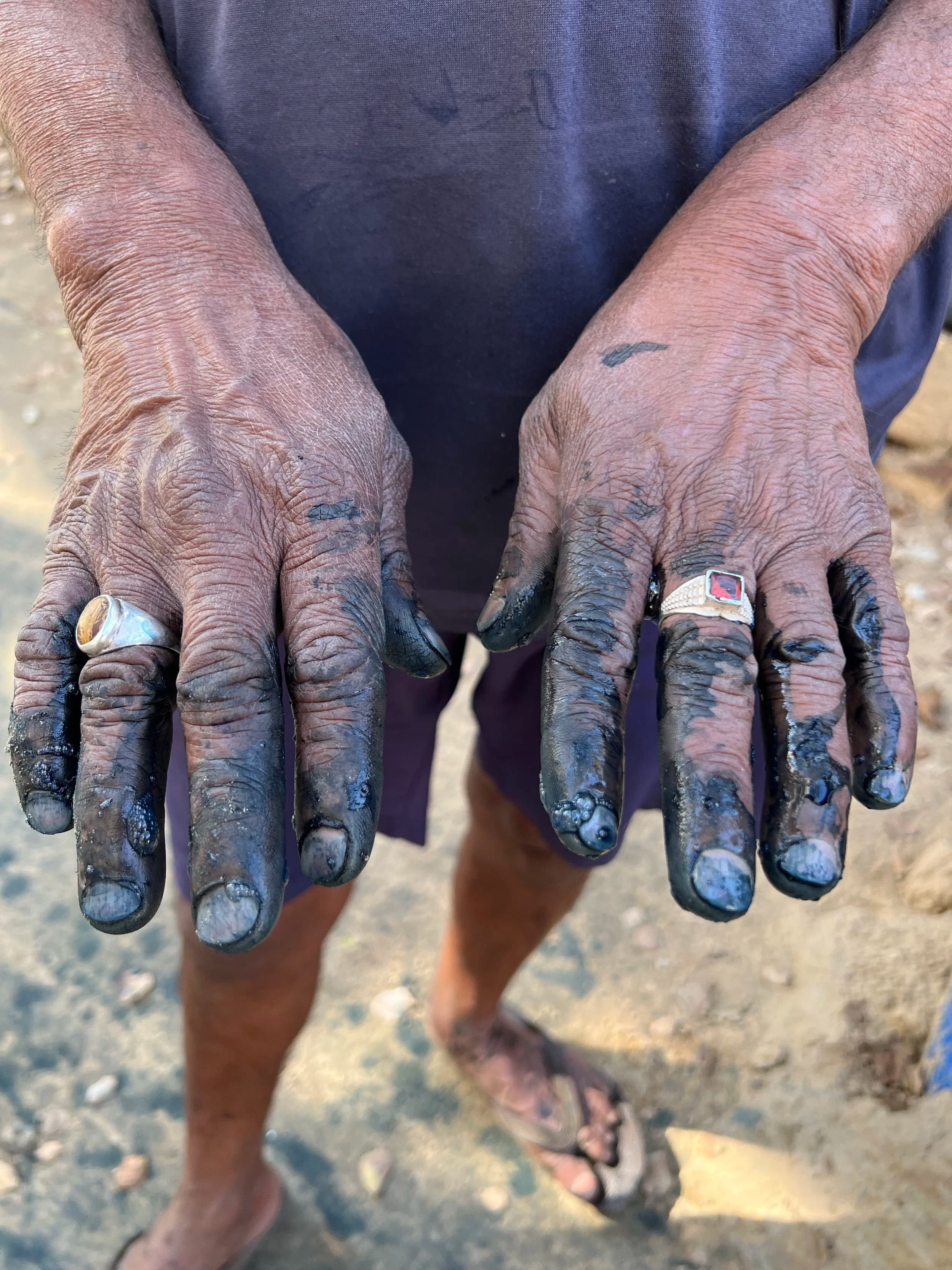 Dyer's hands stained with indigo
